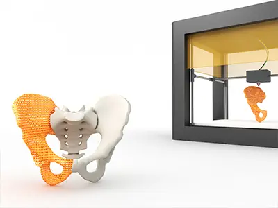 A Supply Chain Model Of Hip Stem Prostheses Produced Using 3d Printing: A Comprehensive Description Of The Simulation Model